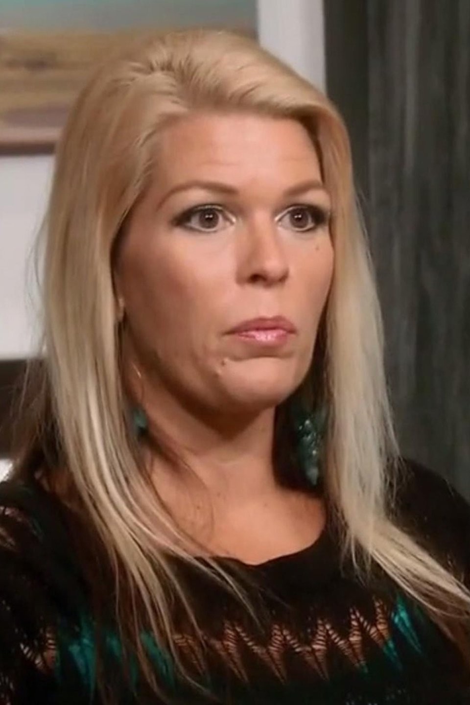 botched full episodes